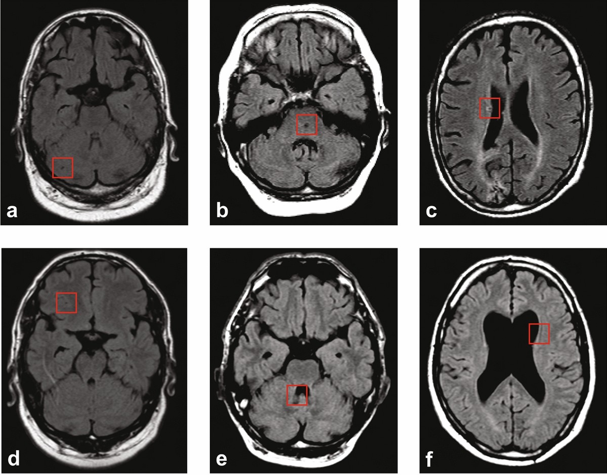 Medical imaging